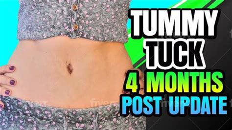 wearing a bikini with a tummy|post tummy tuck looks good.